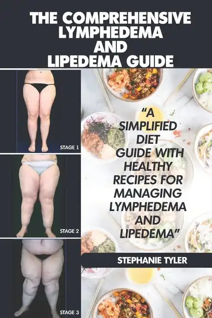 The Comprehensive Lymphedema and Lipedema Guide: The Comprehensive Lymphedema and Lipedema Guide - Paperback