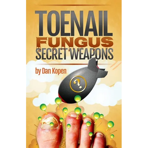 Toenail Fungus Secret Weapons: Uncover over 14 toenail fungus treatments that you can combine to clear your toe nails in under 45 days! - Paperback