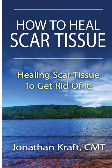 How to Heal Scar Tissue: How to Heal Your Own Scar Tissue And Get Rid Of It! - Paperback