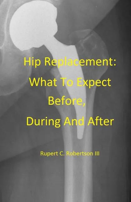 Hip Replacement: What To Expect Before, During and After - Paperback