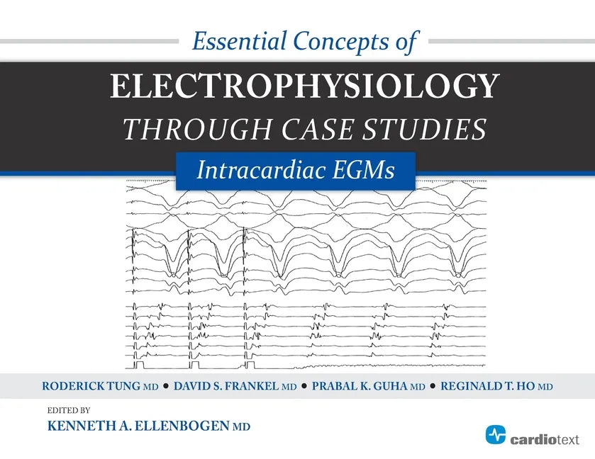 Essential Concepts of Electrophysiology Through Case Studies: Intracardiac EGMs: Intracardiac EGMs - Paperback