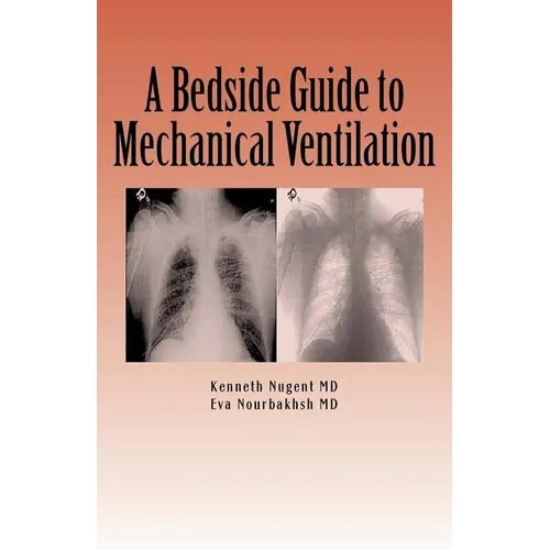 A Bedside Guide to Mechanical Ventilation - Paperback