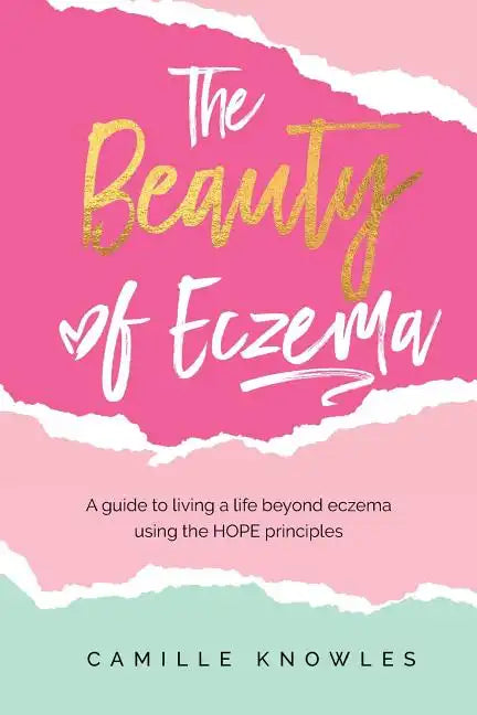 The Beauty of Eczema: A Guide To Living a Life Beyond Eczema Using The Hope Principles - Paperback
