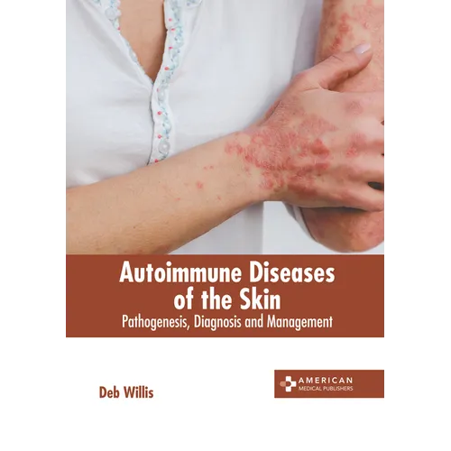 Autoimmune Diseases of the Skin: Pathogenesis, Diagnosis and Management - Hardcover