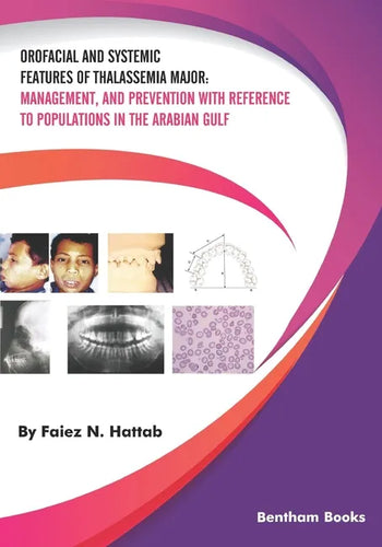Orofacial and Systemic Features of Thalassemia Major: Management, and Prevention with Reference to Populations in the Arabian Gulf - Paperback