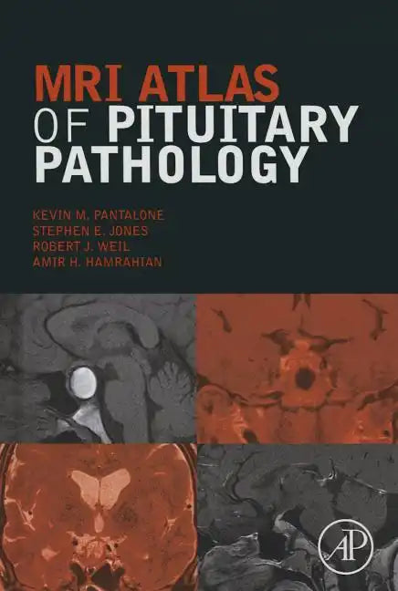 MRI Atlas of Pituitary Pathology - Hardcover