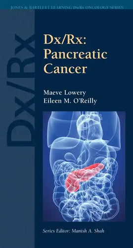 DX/Rx: Pancreatic Cancer: Pancreatic Cancer - Paperback