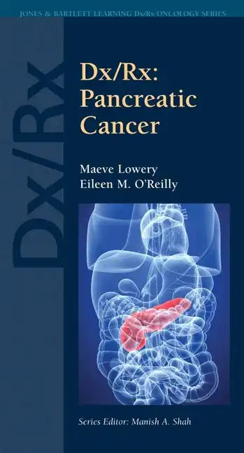 DX/Rx: Pancreatic Cancer: Pancreatic Cancer - Paperback