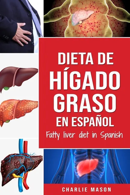 Dieta de hígado graso en español/Fatty liver diet in Spanish - Paperback