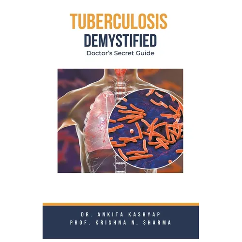 Tuberculosis Demystified: Doctor's Secret Guide - Paperback