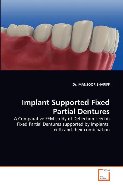 Implant Supported Fixed Partial Dentures - Paperback