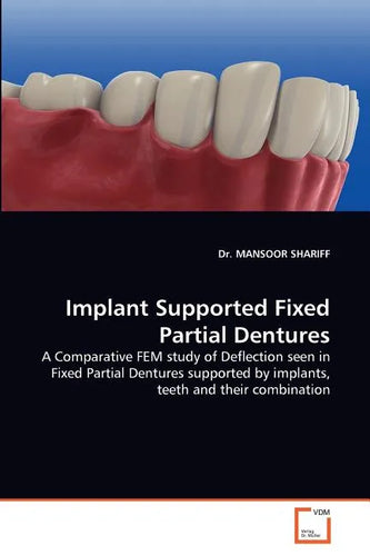 Implant Supported Fixed Partial Dentures - Paperback