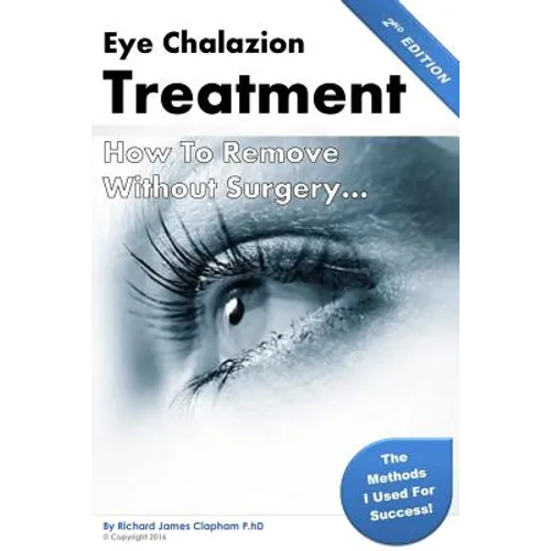 Eye Chalazion: How To Remove Without Surgery: My personal experience and the methods I used for success - Paperback