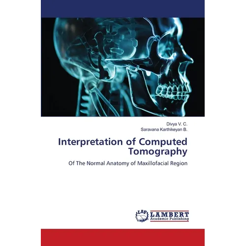 Interpretation of Computed Tomography - Paperback