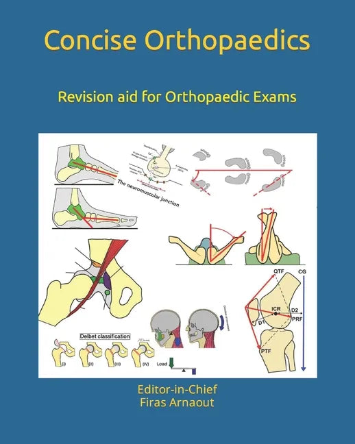 Concise Orthopaedic Notes: Revision aid for FRCS, EBOT , SICOT and Board Examinations - Paperback