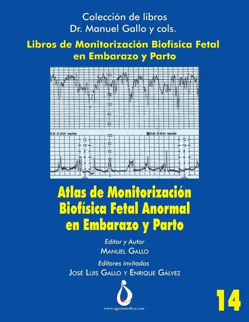 Atlas de Monitorizacion Biofisica Fetal Anormal En El Embarazo Y Parto - Paperback
