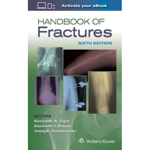 Handbook of Fractures - Paperback