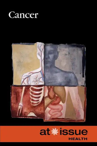 Cancer - Paperback