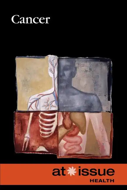 Cancer - Paperback