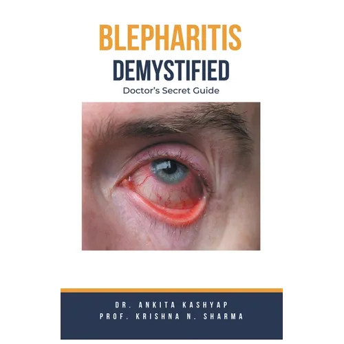 Blepharitis Demystified: Doctor's Secret Guide - Paperback