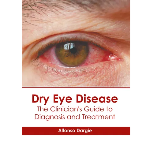 Dry Eye Disease: The Clinician's Guide to Diagnosis and Treatment - Hardcover
