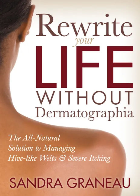 Rewrite Your Life Without Dermatographia: The All-Natural Solution to Managing Hive-Like Welts and Severe Itching - Paperback