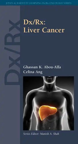 DX/Rx: Liver Cancer: Liver Cancer - Paperback