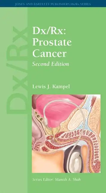 DX/Rx: Prostate Cancer: Prostate Cancer - Paperback