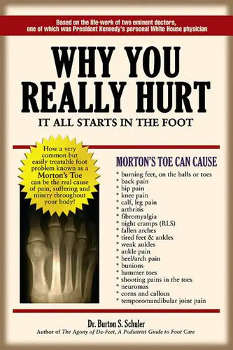 Why You Really Hurt: It All Starts in the Foot - Paperback