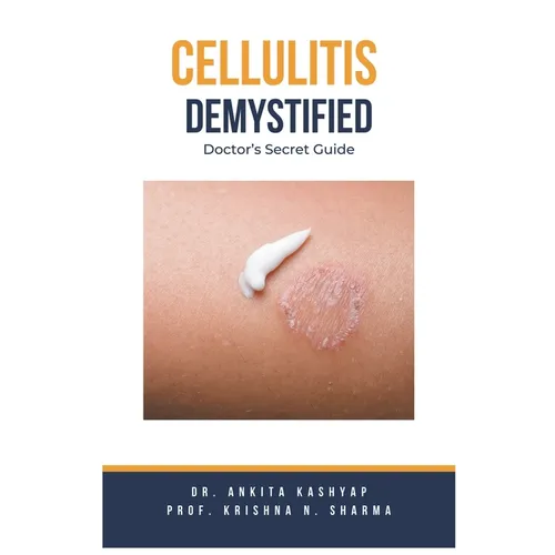 Cellulitis Demystified: Doctor's Secret Guide - Paperback