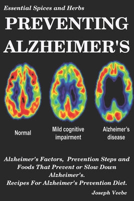 Preventing Alzheimer's: Alzheimer's Factors, Prevention Steps and Foods That Prevent or Slow Alzheimer's, Recipes for Alzheimer's Prevention Diet - Paperback