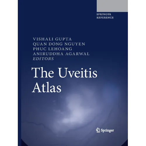 The Uveitis Atlas - Hardcover