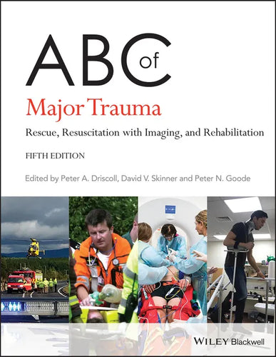 ABC of Major Trauma: Rescue, Resuscitation with Imaging, and Rehabilitation - Paperback
