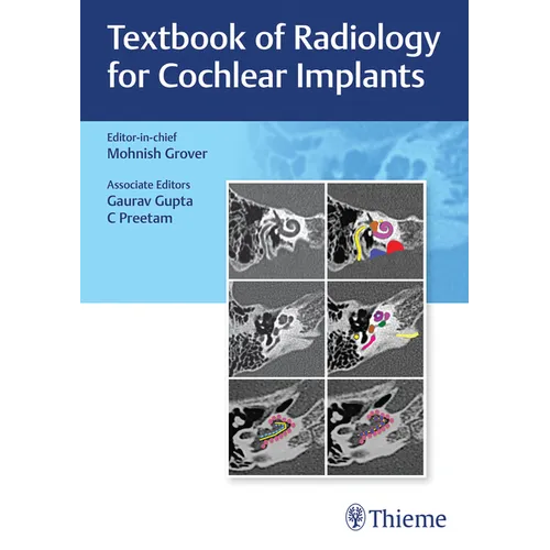 Textbook of Radiology for Cochlear Implants - Hardcover