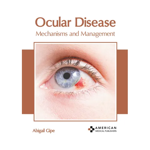 Ocular Disease: Mechanisms and Management - Hardcover