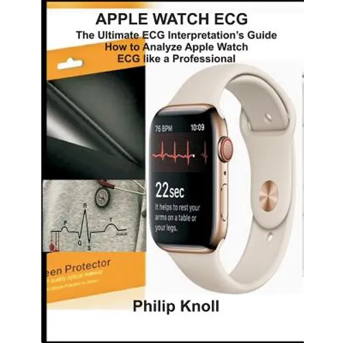Apple Watch ECG: The Ultimate ECG Interpretation Guide; How to Analyze Apple Watch ECG Like a Professional - Paperback