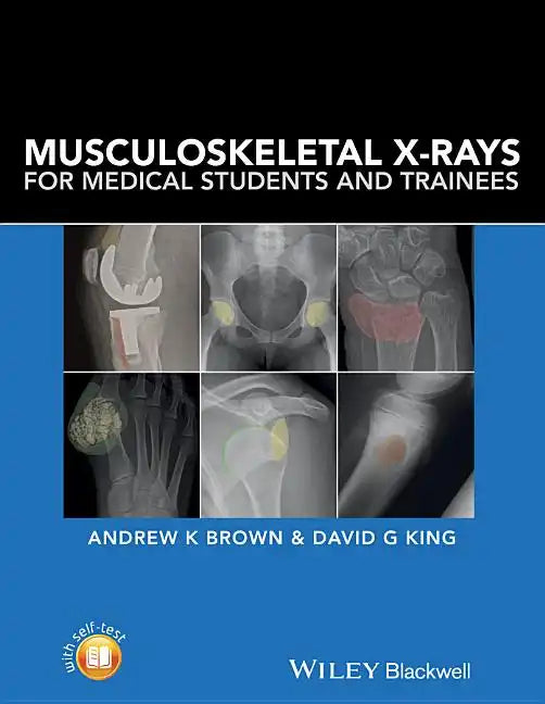 Musculoskeletal X-Rays for Medical Students and Trainees - Paperback