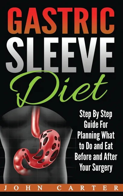 Gastric Sleeve Diet: Step By Step Guide For Planning What to Do and Eat Before and After Your Surgery - Hardcover