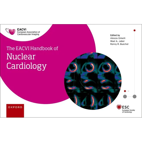 The Eacvi Handbook of Nuclear Cardiology - Paperback