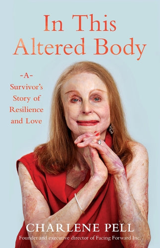 In This Altered Body: A Survivor's Story of Resilience and Love - Paperback