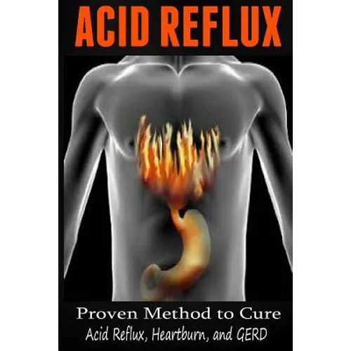 Acid Reflux: Proven Methods to Cure Acid Reflux, Heartburn, and GERD - Paperback
