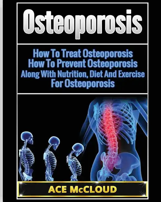 Osteoporosis: How To Treat Osteoporosis: How To Prevent Osteoporosis: Along With Nutrition, Diet And Exercise For Osteoporosis - Paperback