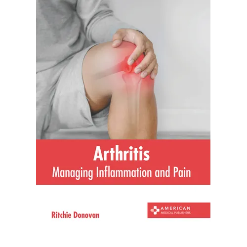 Arthritis: Managing Inflammation and Pain - Hardcover