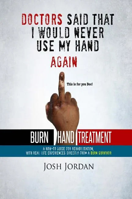 Burn Hand Treatment: A How-To Guide for Rehabilitation with Real Life Experiences from a Burn Survivor - Paperback