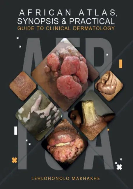 African Atlas, Synopsis & Practical Guide to Clinical Dermatology - Paperback
