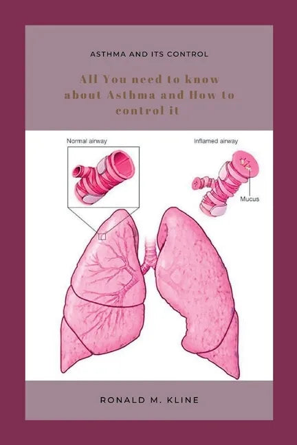 Asthma and its control: All you need to know about Asthma and how to control it. - Paperback