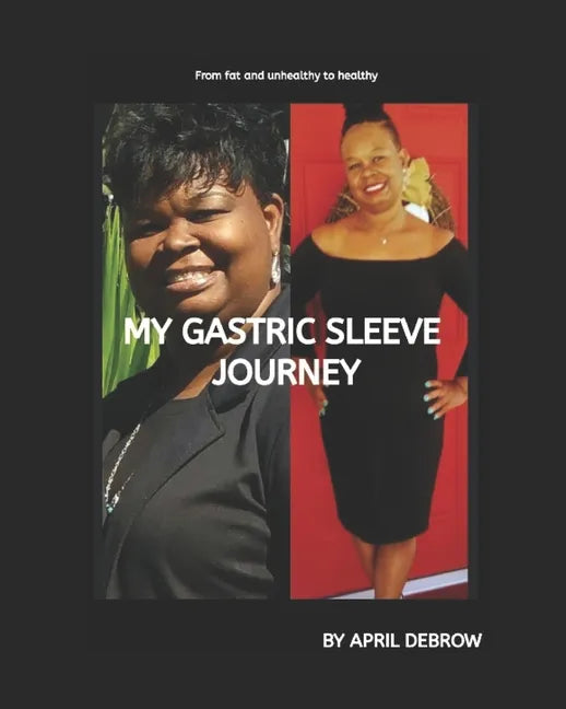 My Gastric Sleeve Journey: The ends and Outs About Gastric Sleeve - Paperback