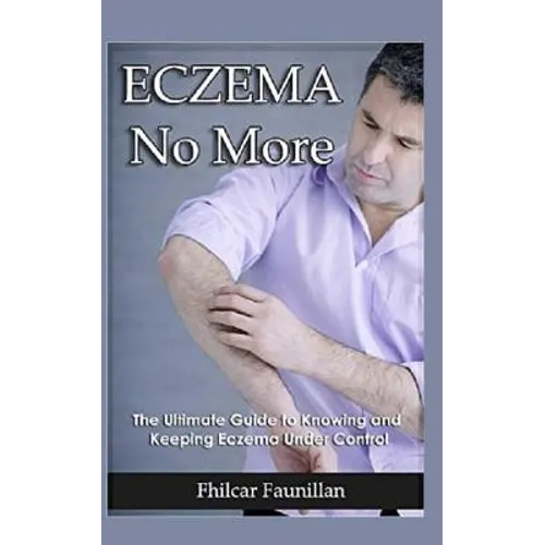 Eczema Cure: Eczema No More - The Ultimate Guide to Knowing and Keeping Eczema Under Control - Paperback