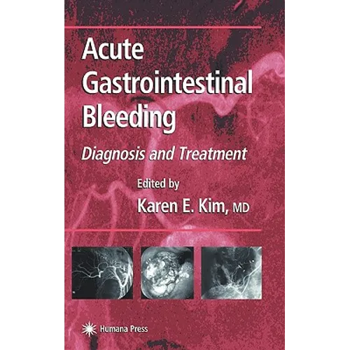 Acute Gastrointestinal Bleeding: Diagnosis and Treatment - Hardcover
