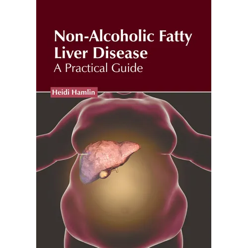 Non-Alcoholic Fatty Liver Disease: A Practical Guide - Hardcover